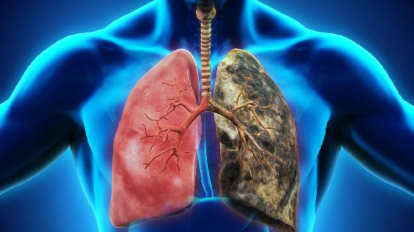 最伤肺病的5种行为，吸烟居然不是排第一，看看都有哪些