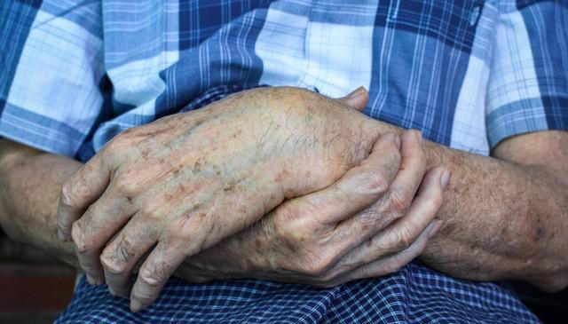 有的人长满“老年斑”，有的却干干净净？医生说出实情