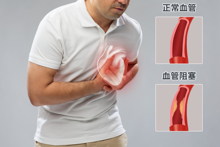 研究发现:血管变硬,或早餐吃错