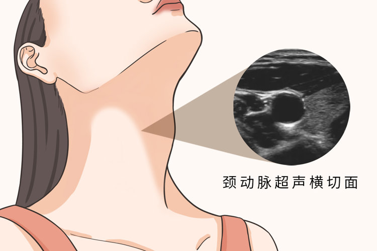 研究发现:血管变硬,或早餐吃错
