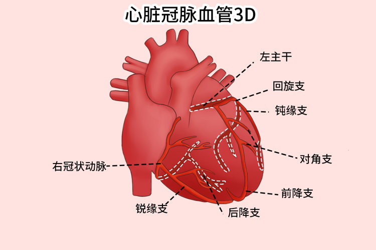 研究发现:血管变硬,或早餐吃错