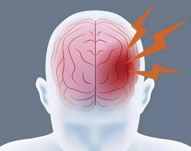脑供血不足，身体或出现6个症状，老人如何预防？7个建议听一听