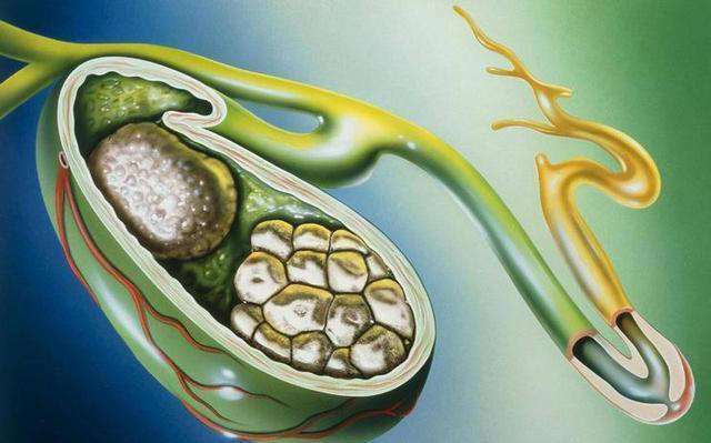 小米粥可以当早餐吗？医生：尽量少吃这5种早餐