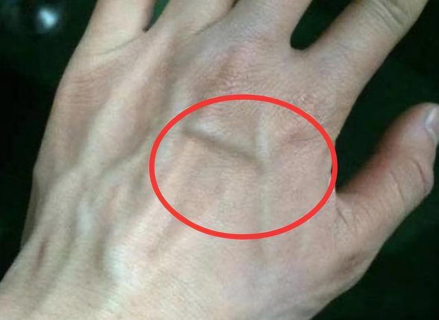 为何有的人手臂“青筋暴起”，而有的人几乎看不到，哪个更健康？