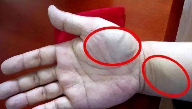 为何有的人手臂“青筋暴起”，而有的人几乎看不到，哪个更健康？