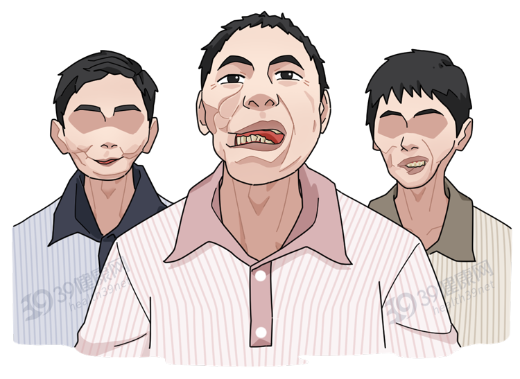 为什么越来越多的人得舌癌?