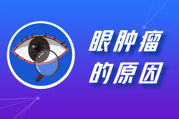 导致眼肿瘤的原因有哪些？常见因素有这几个