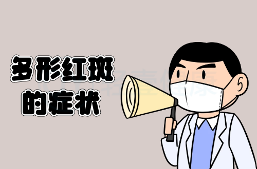 多形红斑的症状有哪些？多为这几个表现