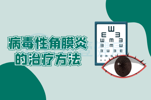病毒性角膜炎的治疗方法有哪些？