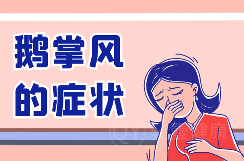 鹅掌风的症状有哪些？多为这几个表现
