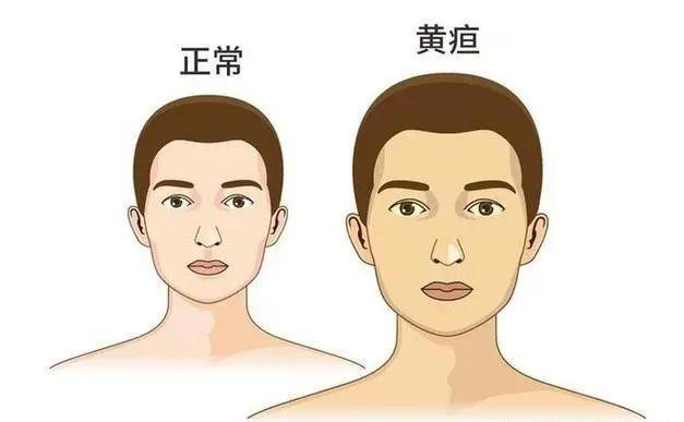 肝不好，头先知！这些头部信号一出现，立即检查别拖延！