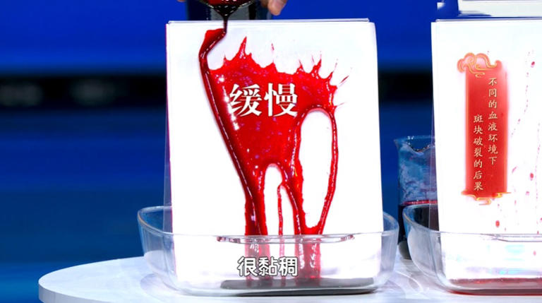 马上停止5类运动，很可能加速血栓形成，等血管“堵死”就迟了