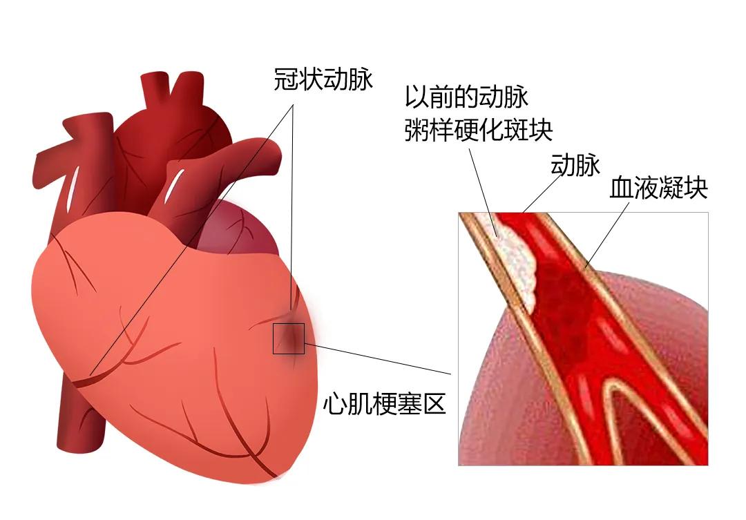 血管疾病与性功能