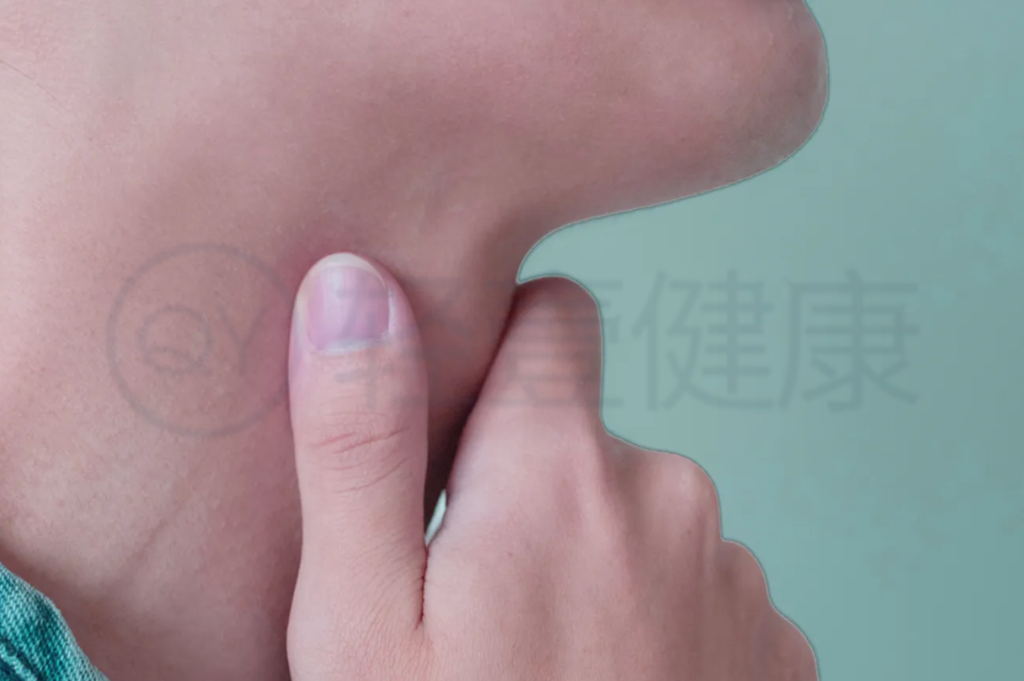 中晚期症状 中晚期症状