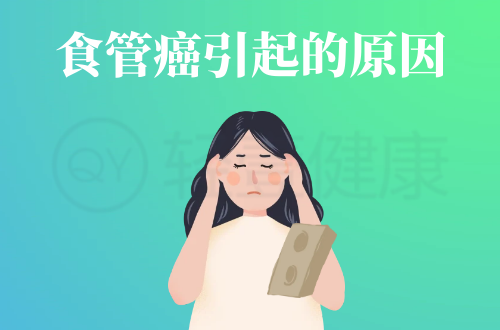 食管癌引起的原因有哪些？常见因素有这几个