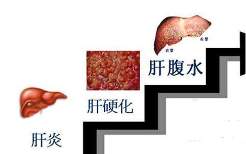 918BEEE3-82BD-4c15-8348-CEA2005D7858.png 918BEEE3-82BD-4c15-8348-CEA2005D7858.png