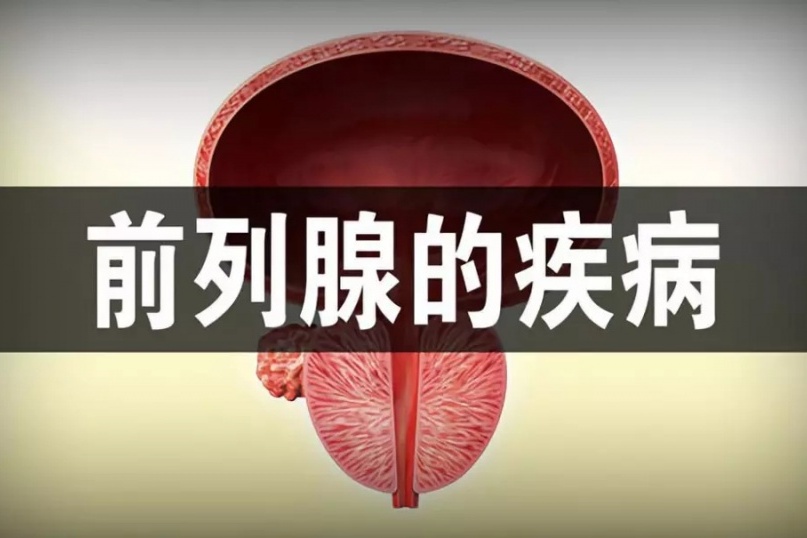 前列腺炎有什么症状及危害有哪些