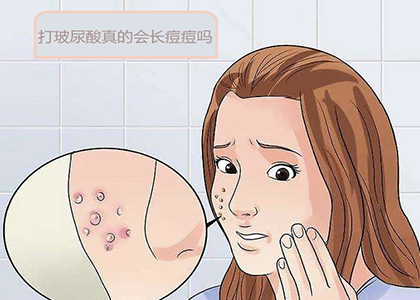 打玻尿酸真的会长痘痘吗