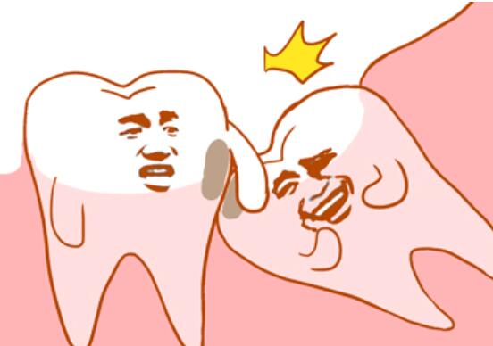 需要拔智齿的情况