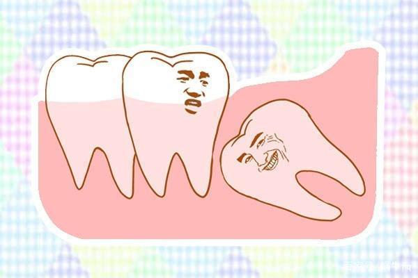 药物治疗拔智齿疼痛