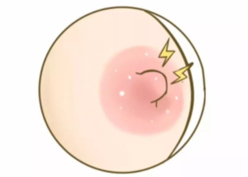 乳房白头