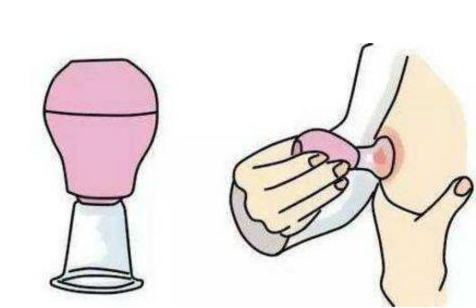掌握正确的哺乳姿势