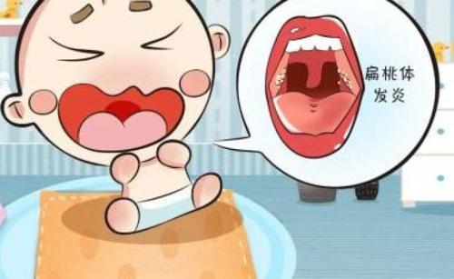 扁桃体发炎会全身有害