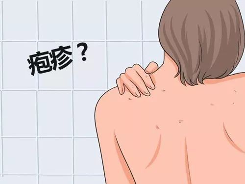 关于疱疹