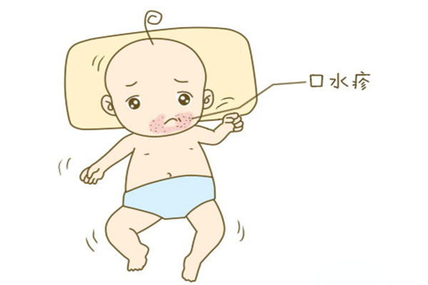 口水疹