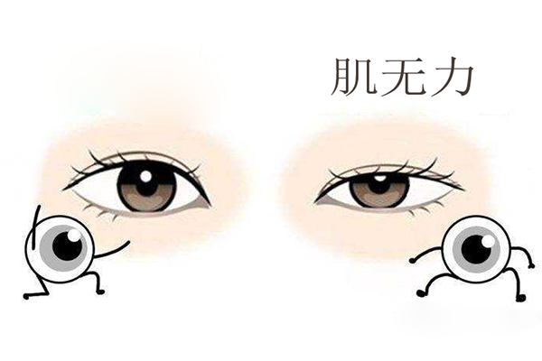眼神无力