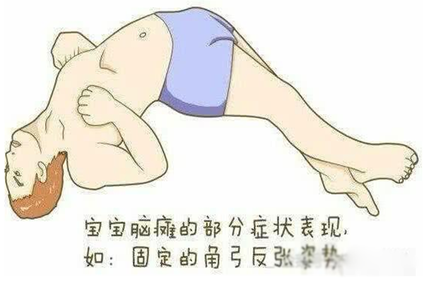 四肢异常