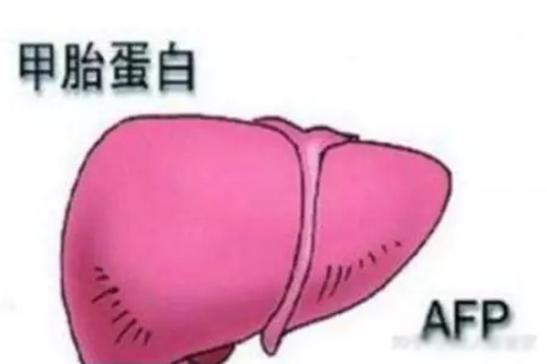 甲胎蛋白升高
