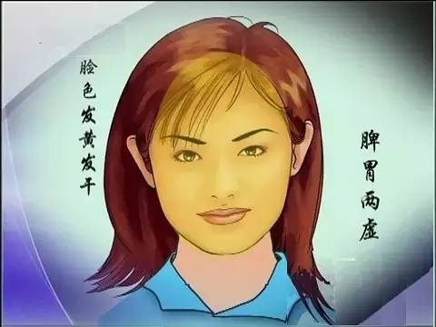脾胃虚会脸色蜡黄