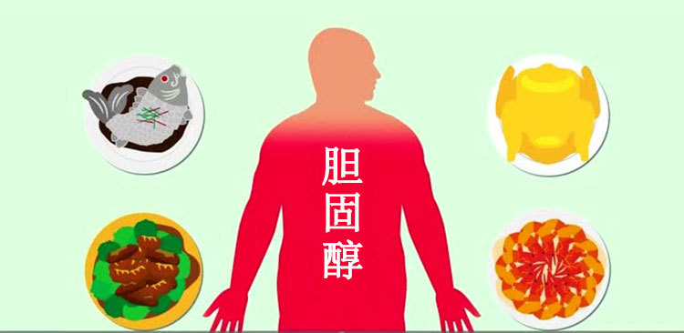 胆固醇高的人，大多有这7个“共性”，看看你占了几个