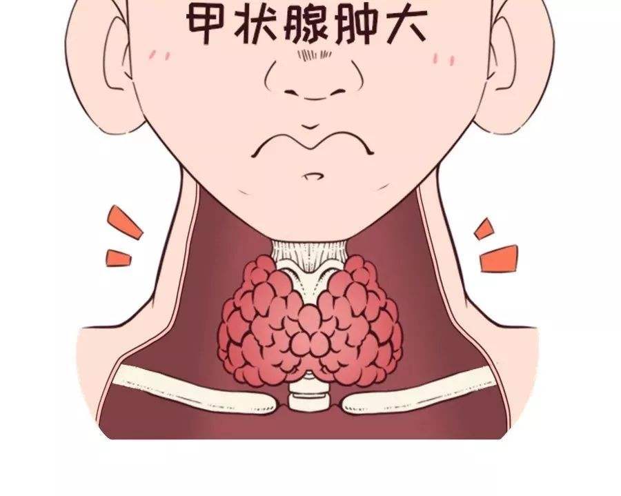 甲状腺炎致甲状腺肿大
