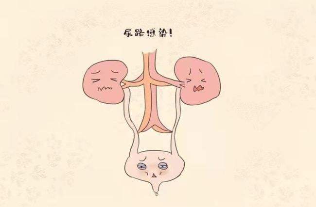 下尿路梗阻导致肾衰竭