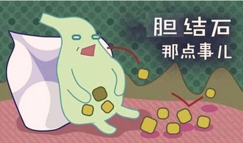胆结石的症状有哪些？身体给出了什么反应