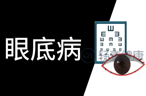 眼底病的症状有哪些？是什么原因导致？