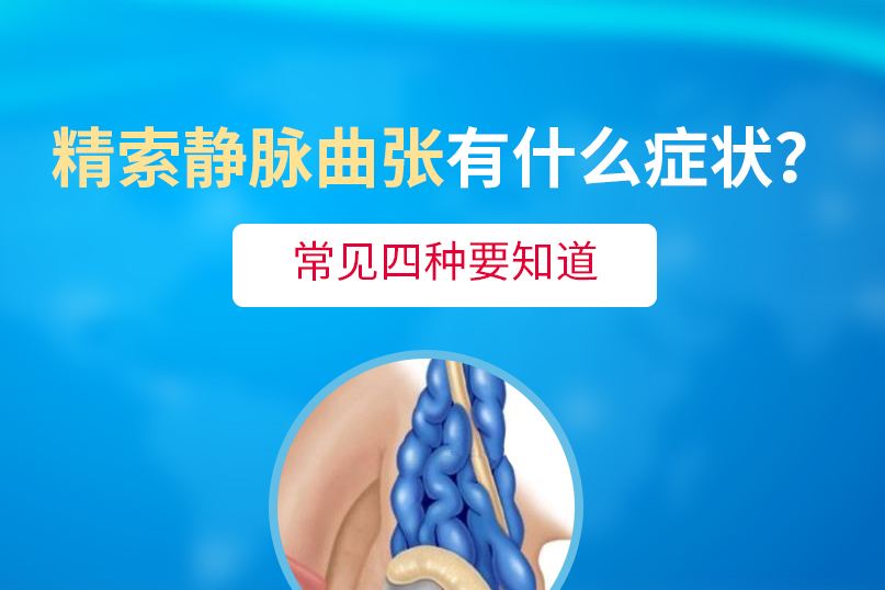 精索静脉曲张的症状表现在哪些地方？