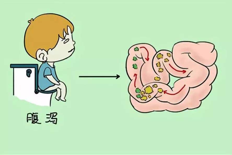 肠胃炎导致腹泻 肠胃炎导致腹泻