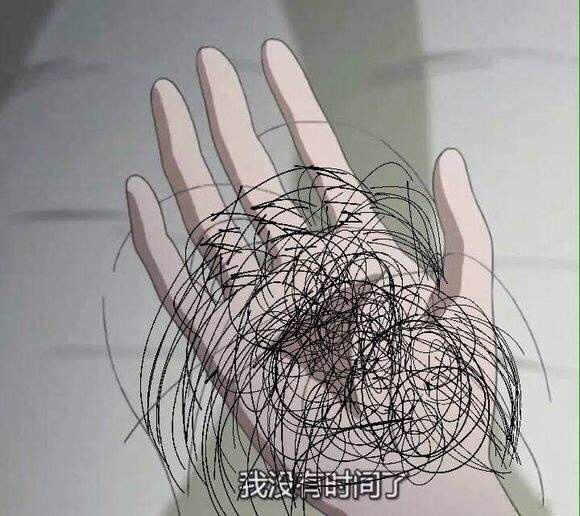 脂溢性脱发 脂溢性脱发