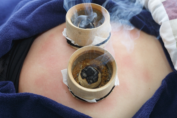 艾灸期间可以洗澡吗 洗澡时机参考 艾灸期间可以洗澡吗