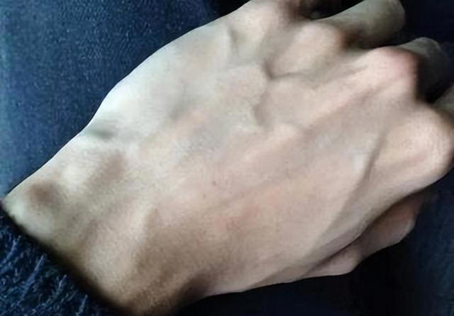 手背血管能看出寿命长短？医生：血管若有这些特征，恭喜你很健康