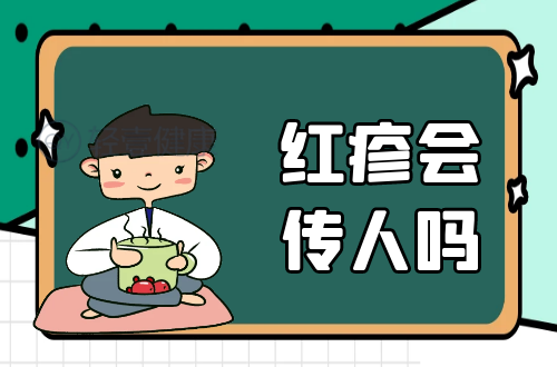 红疹会传人吗？