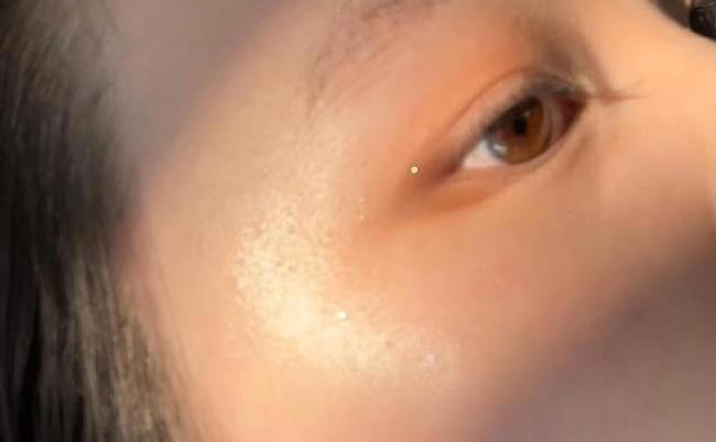 为什么有人满脸老年斑却有人皮肤干净
