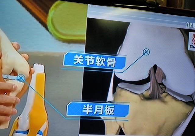 走路时，膝盖突然发软？别以为是缺钙了，或是3种疾病的暗示