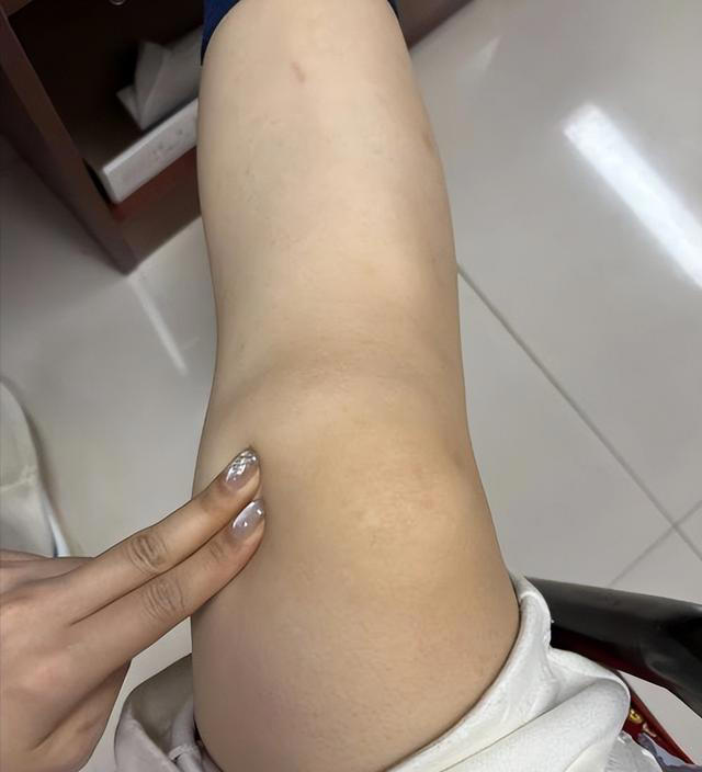 走路时，膝盖突然发软？别以为是缺钙了，或是3种疾病的暗示