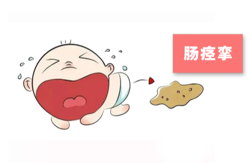 肠痉挛的症状有哪些？如何缓解？