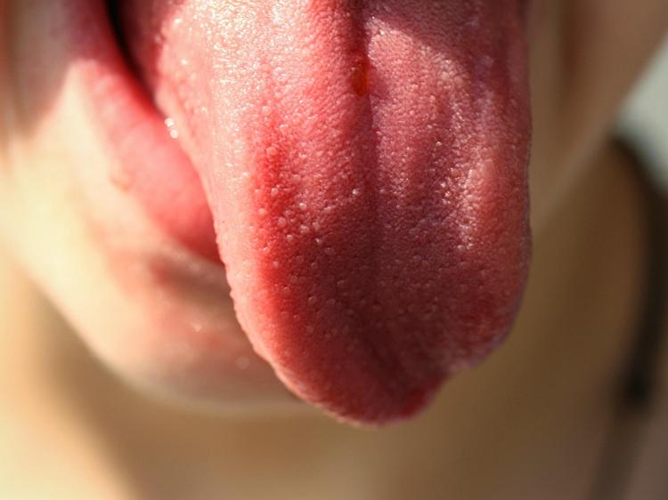 口臭牙缝酸臭？根源剖析与科学解法