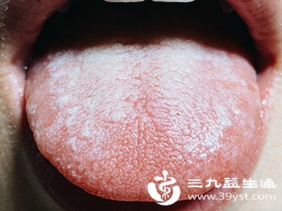 水湿内停:肢体浮肿与舌苔厚腻 水湿内停:肢体浮肿与舌苔厚腻